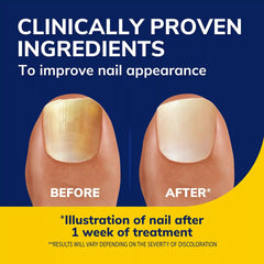 Fungal Nail Revitalizer Liquid & Refill