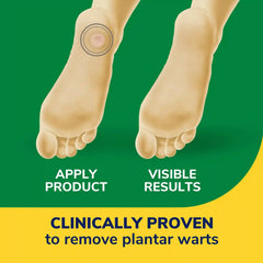 Clear Away® Plantar Wart Removers