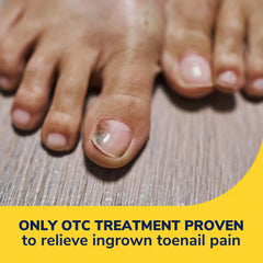 Ingrown Toenail Pain Reliever